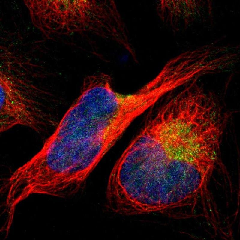 ACSL1 Antibody - BSA Free Immunocytochemistry/ Immunofluorescence: ACSL1 Antibody [NBP1-89270]