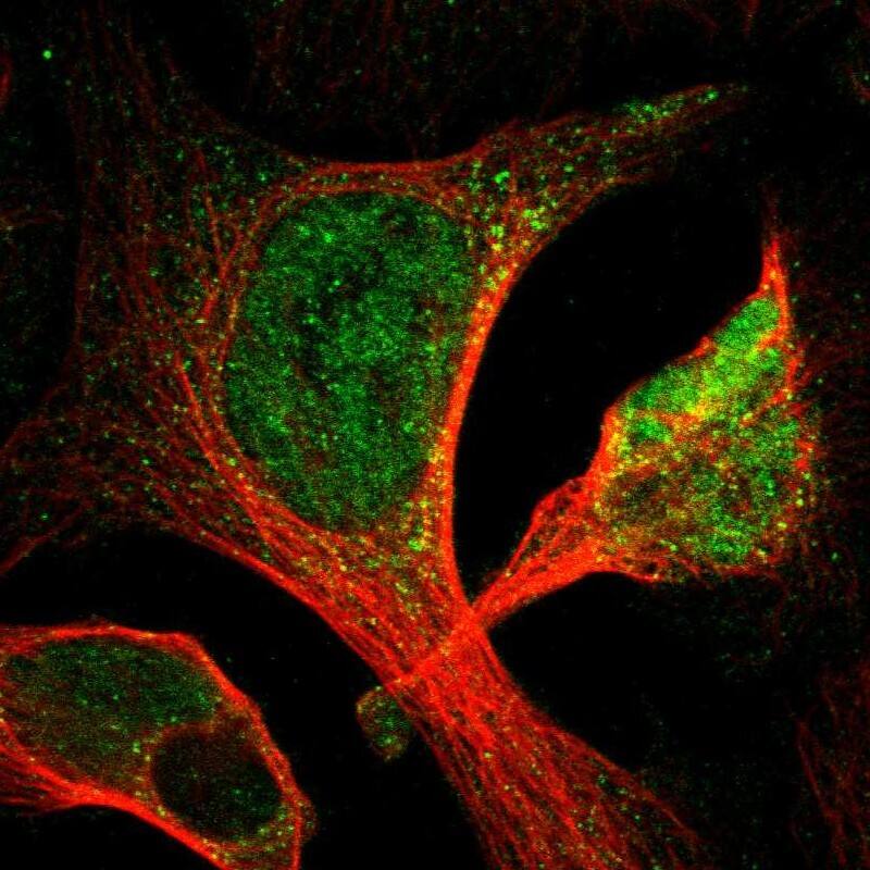 ACSL1 Antibody - BSA Free Immunocytochemistry/ Immunofluorescence: ACSL1 Antibody [NBP1-89271]