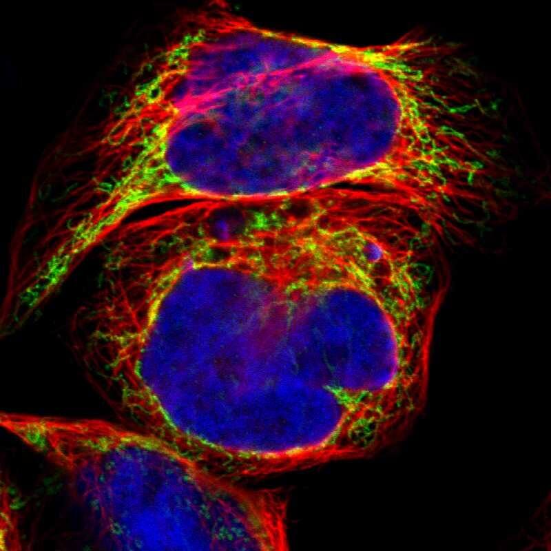 ACAT1 Antibody - BSA Free Immunocytochemistry/ Immunofluorescence: ACAT1 Antibody [NBP1-89285]
