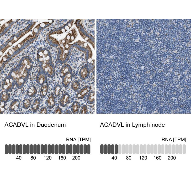 ACADVL Antibody - BSA Free Immunohistochemistry-Paraffin: ACADVL Antibody [NBP1-89287]