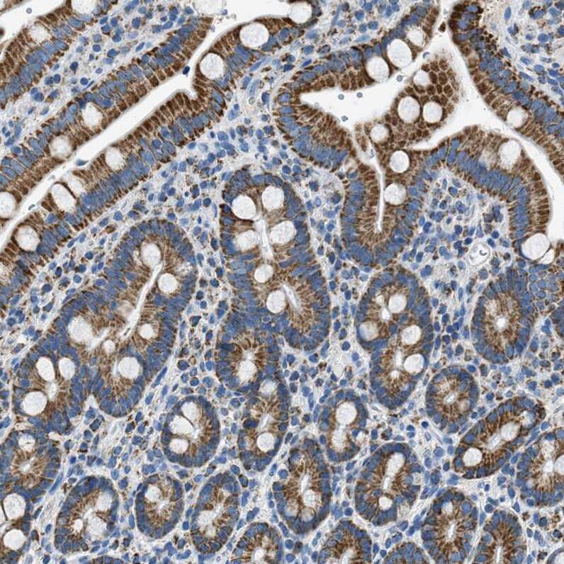 ACADVL Antibody - BSA Free Immunohistochemistry-Paraffin: ACADVL Antibody [NBP1-89287]