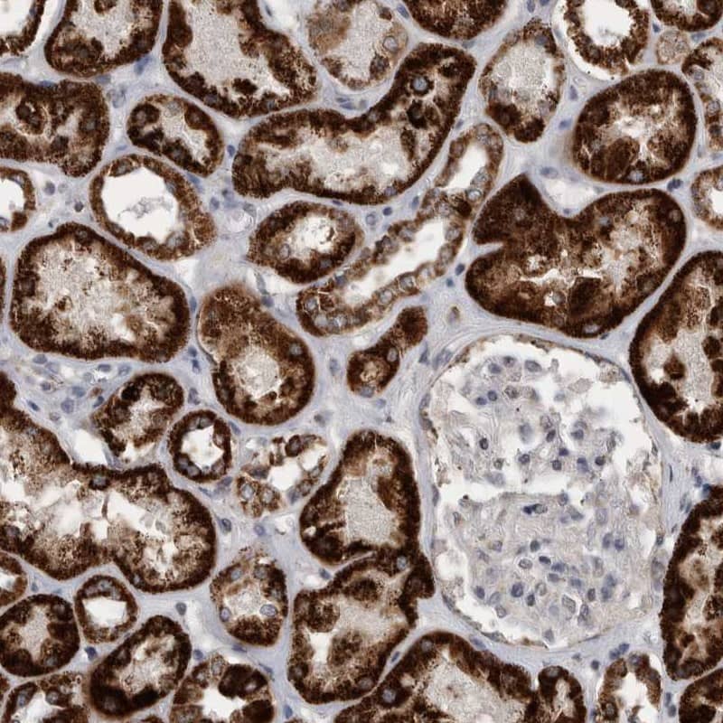 ACADM Antibody - BSA Free Immunohistochemistry: ACADM Antibody [NBP1-89293]