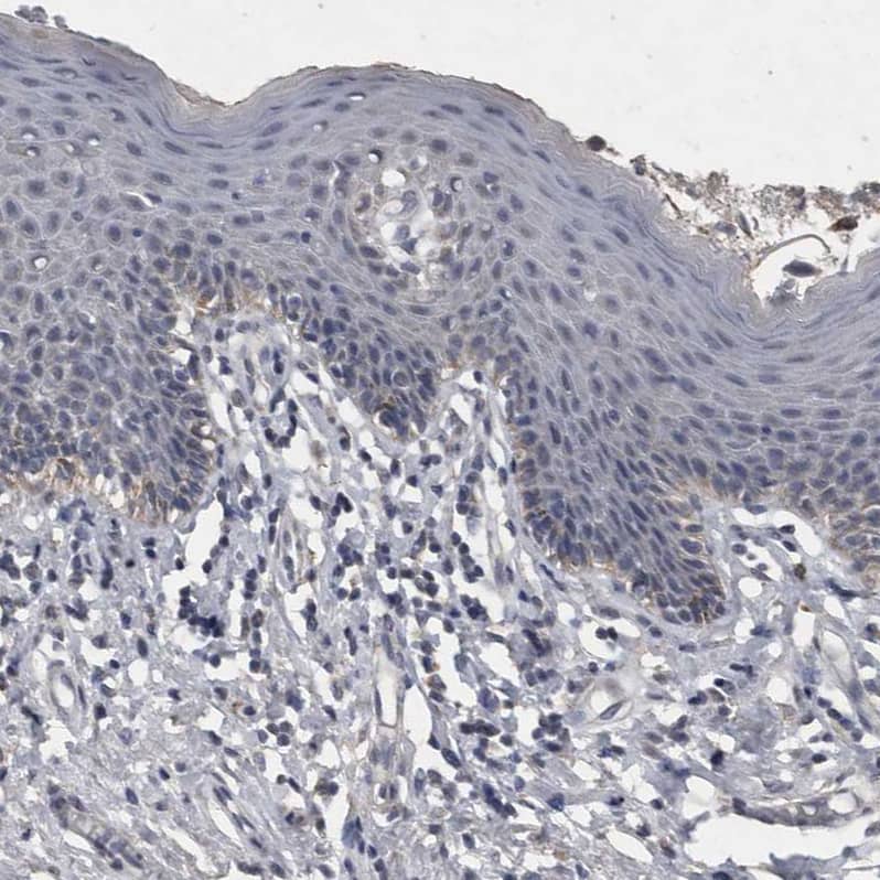 ACADM Antibody - BSA Free Immunohistochemistry: ACADM Antibody [NBP1-89293]
