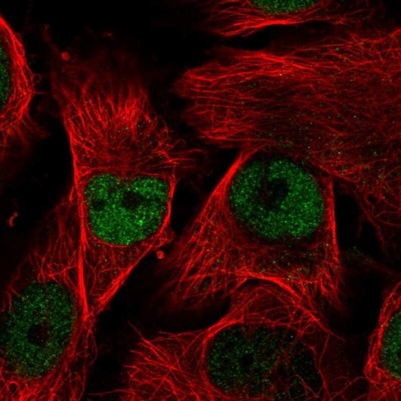 MORC2 Antibody - BSA Free Immunocytochemistry/ Immunofluorescence: MORC2 Antibody [NBP1-89295] -