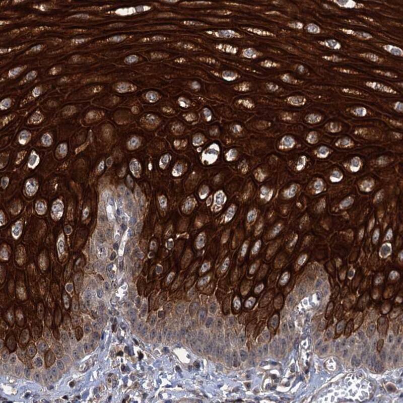ABLIM1 Antibody - BSA Free Immunohistochemistry-Paraffin: ABLIM1 Antibody [NBP1-89303]