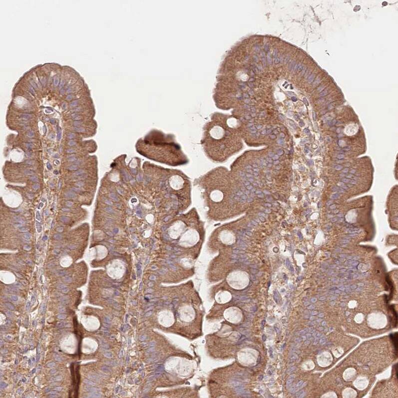 TNIP1 Antibody - BSA Free Immunohistochemistry-Paraffin: TNIP1 Antibody [NBP1-89306]