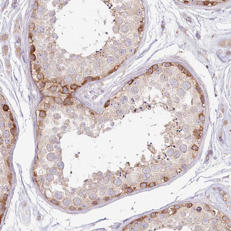 TNIP1 Antibody - BSA Free Immunohistochemistry-Paraffin: TNIP1 Antibody [NBP1-89306]