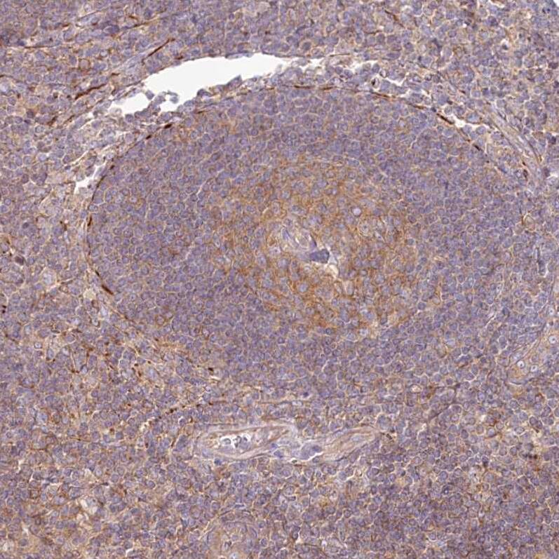 TNIP1 Antibody - BSA Free Immunohistochemistry-Paraffin: TNIP1 Antibody [NBP1-89306]