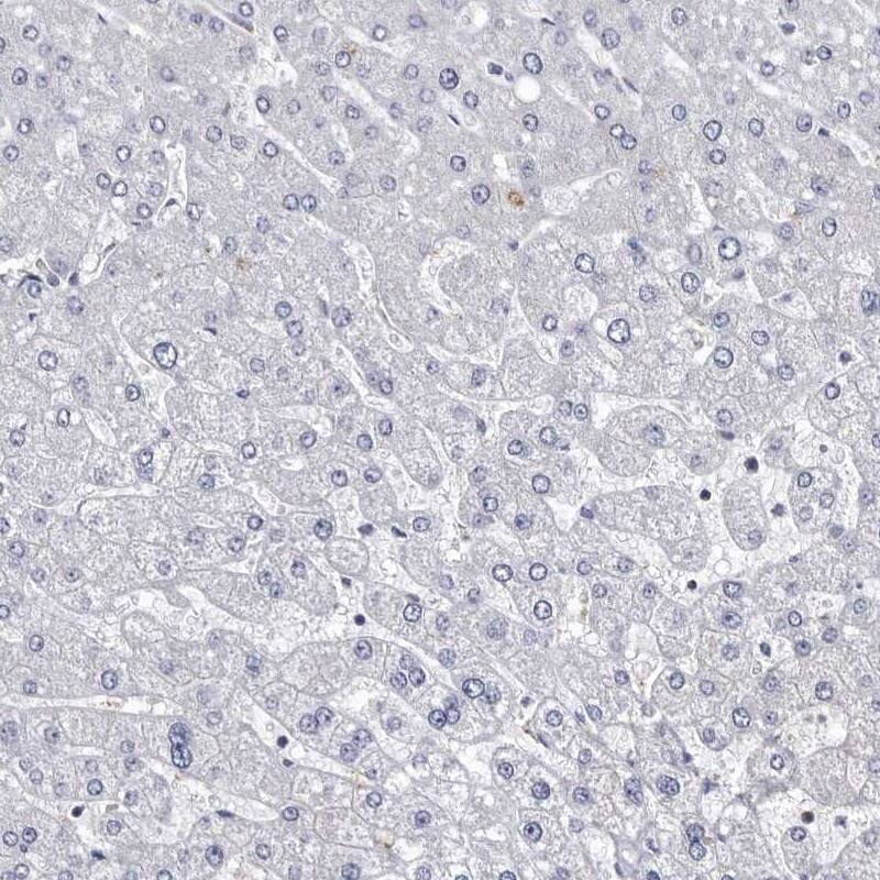 ABCF2 Antibody - BSA Free Immunohistochemistry-Paraffin: ABCF2 Antibody [NBP1-89316]