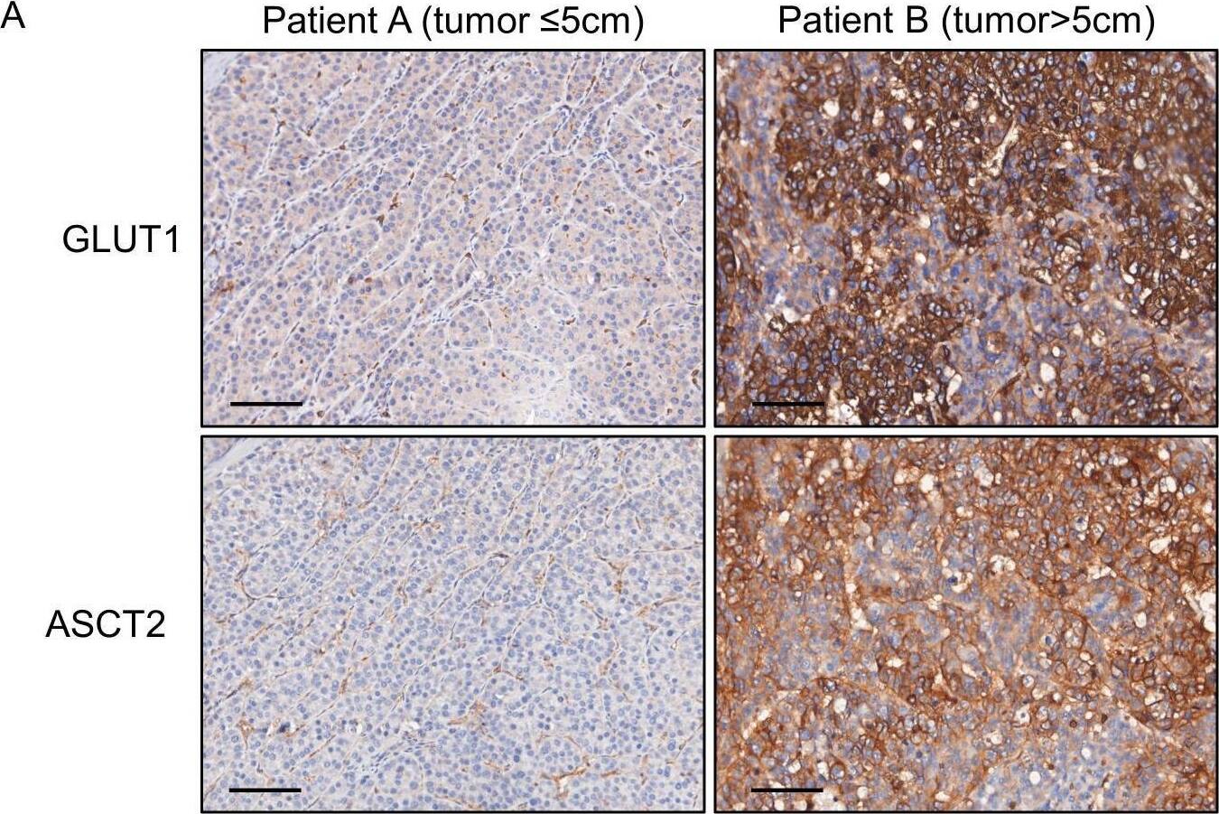SLC1A5 Antibody - BSA Free