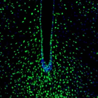 ZNF3 Antibody - BSA Free Immunohistochemistry-Paraffin: ZNF3 Antibody [NBP1-89329]
