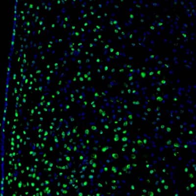 ZNF3 Antibody - BSA Free Immunohistochemistry-Paraffin: ZNF3 Antibody [NBP1-89329]