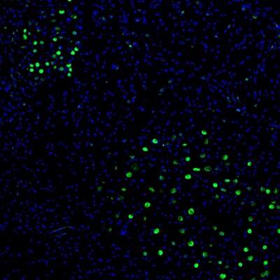 ZNF3 Antibody - BSA Free Immunohistochemistry-Paraffin: ZNF3 Antibody [NBP1-89329]