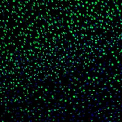 ZNF3 Antibody - BSA Free Immunohistochemistry-Paraffin: ZNF3 Antibody [NBP1-89329]