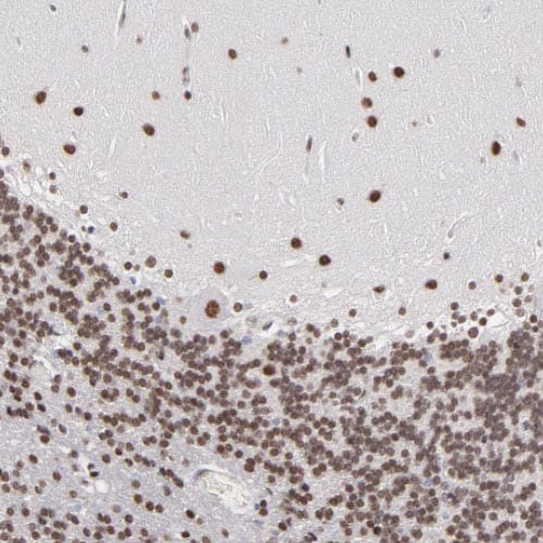 ZNF3 Antibody - BSA Free Immunohistochemistry-Paraffin: ZNF3 Antibody [NBP1-89329]