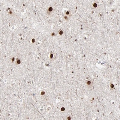ZNF3 Antibody - BSA Free Immunohistochemistry-Paraffin: ZNF3 Antibody [NBP1-89329]