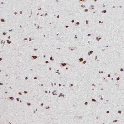 ZNF3 Antibody - BSA Free Immunohistochemistry-Paraffin: ZNF3 Antibody [NBP1-89329]