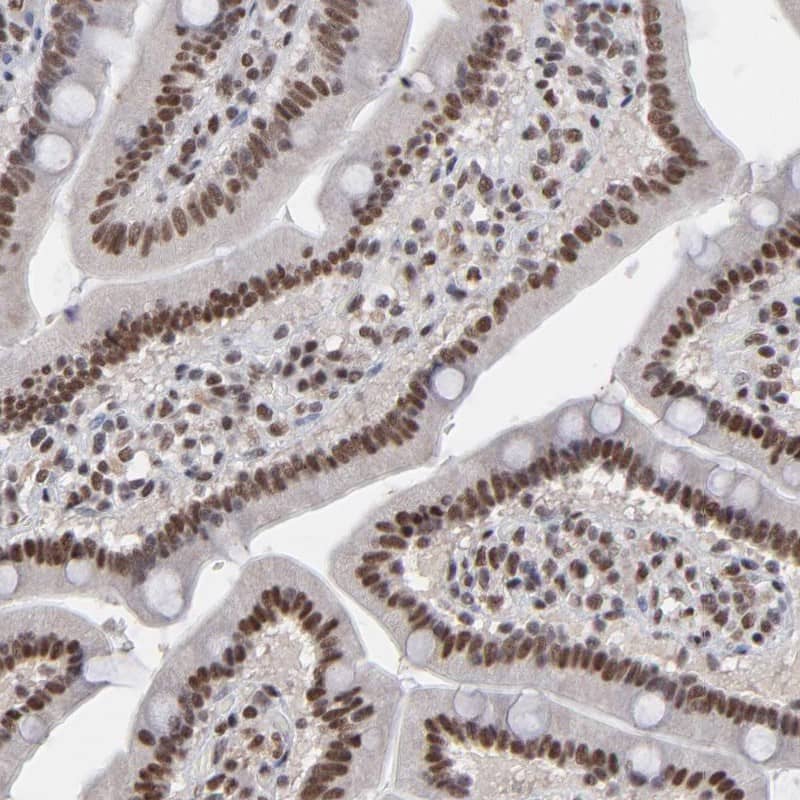 ZNF3 Antibody - BSA Free Immunohistochemistry-Paraffin: ZNF3 Antibody [NBP1-89329]