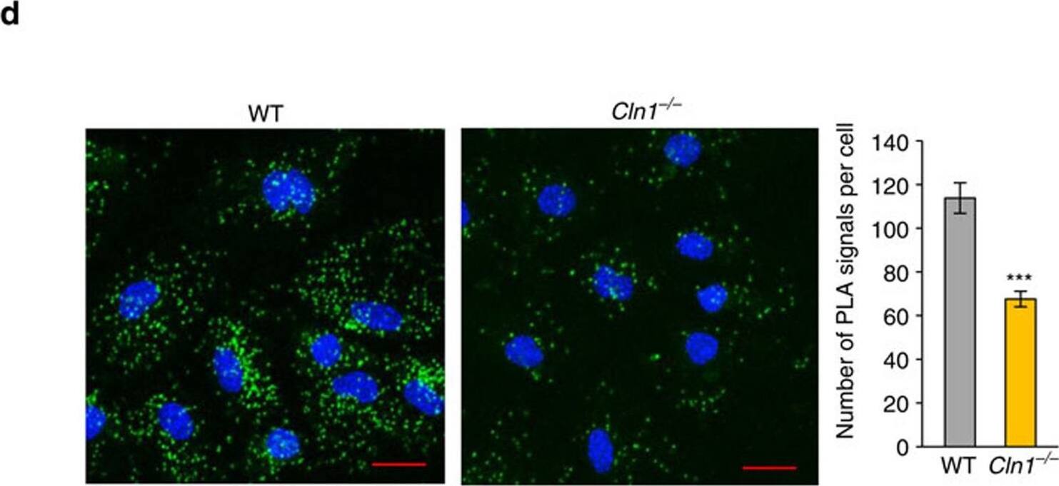 ATP6V0A1 Antibody