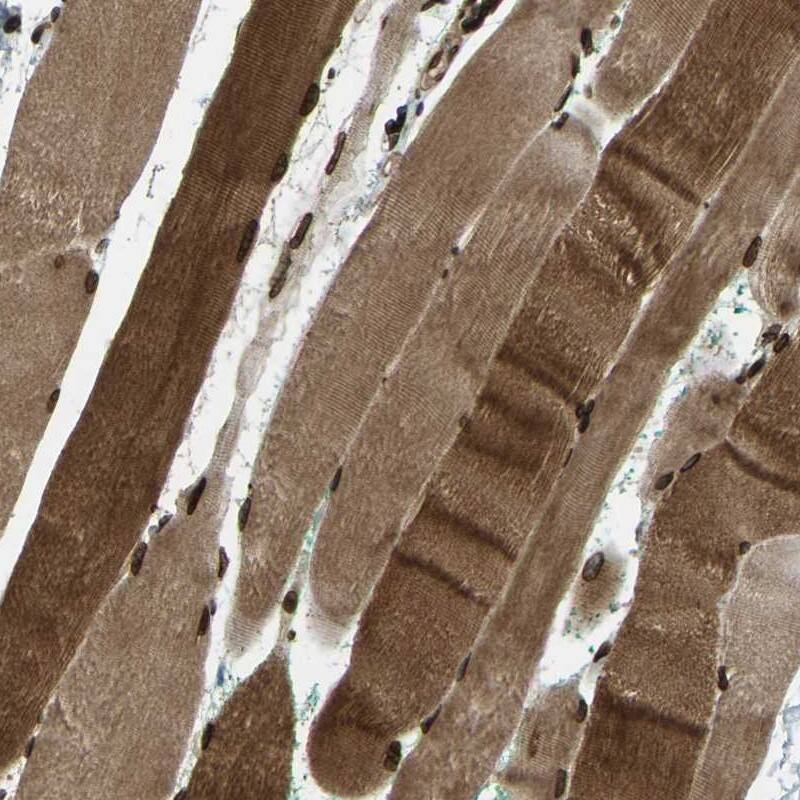 SYNE1 Antibody - BSA Free Immunohistochemistry-Paraffin: SYNE1 Antibody [NBP1-89349]