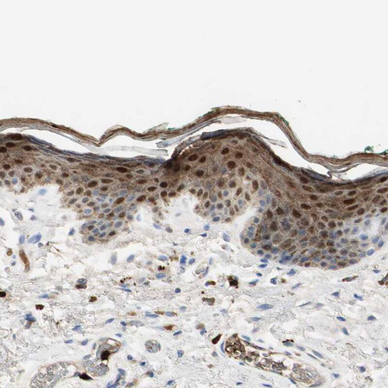 S100A9 Antibody - BSA Free Immunohistochemistry-Paraffin: S100A9 Antibody - BSA Free [NBP1-89360]