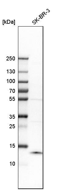 S100A9 Antibody - BSA Free Western Blot: S100A9 Antibody - BSA Free [NBP1-89360]