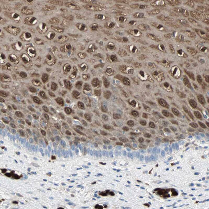 S100A9 Antibody - BSA Free Immunohistochemistry-Paraffin: S100A9 Antibody - BSA Free [NBP1-89360]