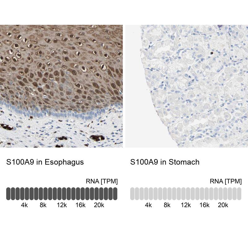 S100A9 Antibody - BSA Free Immunohistochemistry-Paraffin: S100A9 Antibody - BSA Free [NBP1-89360]