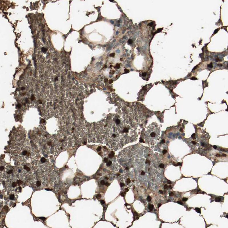 S100A9 Antibody - BSA Free Immunohistochemistry-Paraffin: S100A9 Antibody - BSA Free [NBP1-89360]