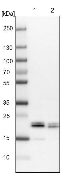 4EBP1 Antibody - BSA Free Western Blot: 4EBP1 Antibody - BSA Free [NBP1-89368]