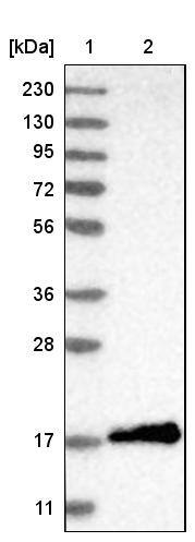 4EBP1 Antibody - BSA Free Western Blot: 4EBP1 Antibody - BSA Free [NBP1-89368]