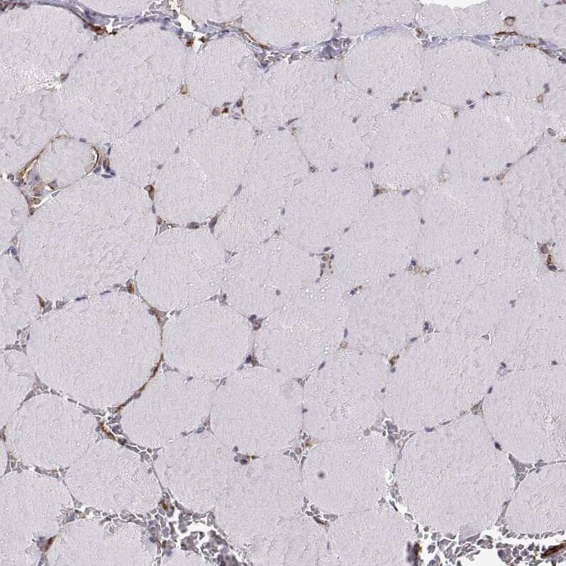 S100A10 Antibody - BSA Free Immunohistochemistry-Paraffin: S100A10 Antibody - BSA Free [NBP1-89370]