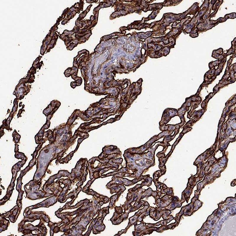 S100A10 Antibody - BSA Free Immunohistochemistry-Paraffin: S100A10 Antibody - BSA Free [NBP1-89370]