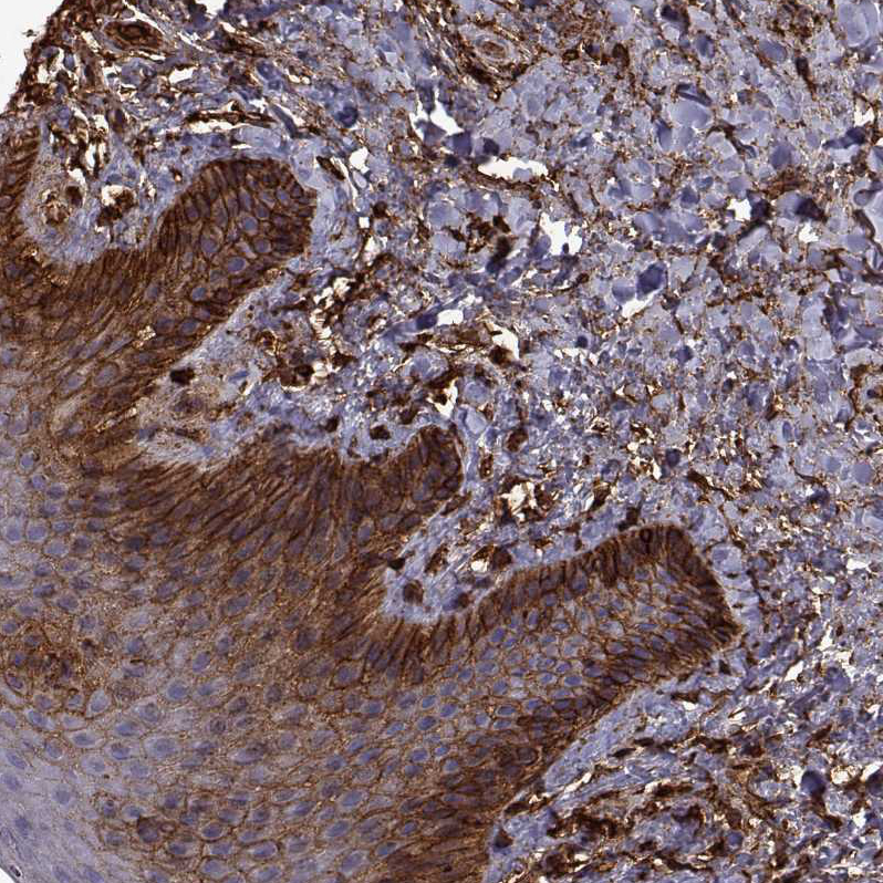 S100A10 Antibody - BSA Free Immunohistochemistry-Paraffin: S100A10 Antibody - BSA Free [NBP1-89370]