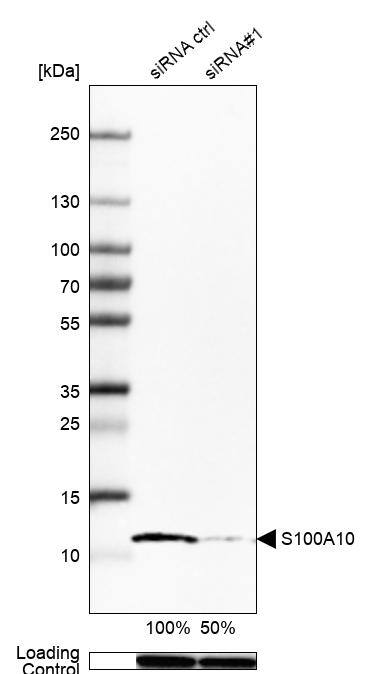 S100A10 Antibody - BSA Free Western Blot: S100A10 Antibody - BSA Free [NBP1-89370]