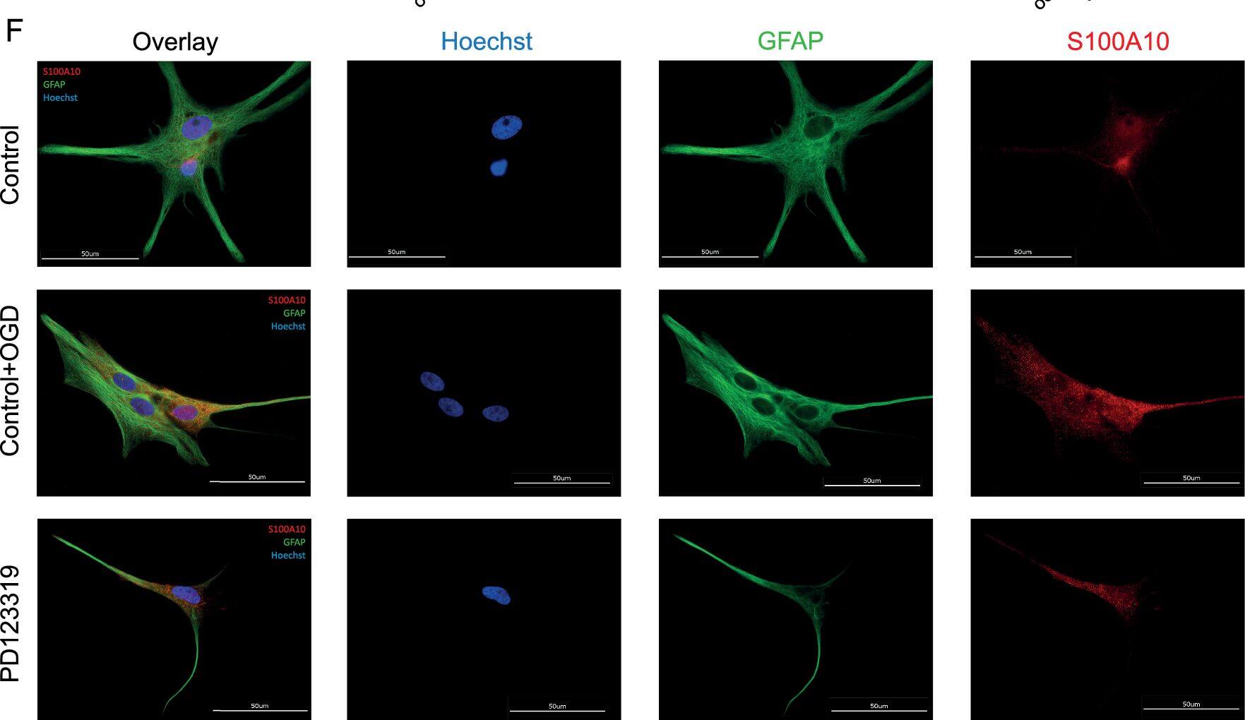 S100A10 Antibody - BSA Free