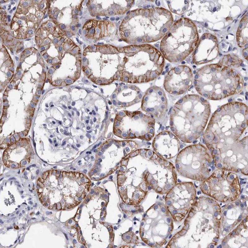 EPB41L3 Antibody - BSA Free Immunohistochemistry-Paraffin: EPB41L3 Antibody - BSA Free [NBP1-89372]