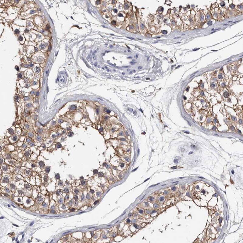 EPB41L3 Antibody - BSA Free Immunohistochemistry-Paraffin: EPB41L3 Antibody - BSA Free [NBP1-89372]