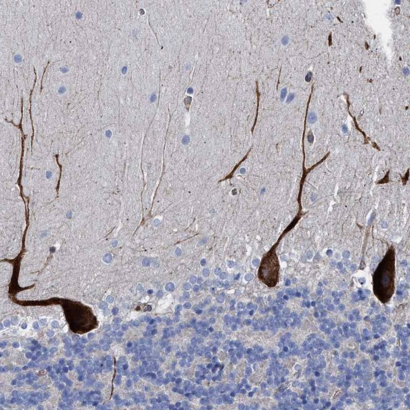 HS3ST5 Antibody - BSA Free Immunohistochemistry-Paraffin: HS3ST5 Antibody - BSA Free [NBP1-89373]