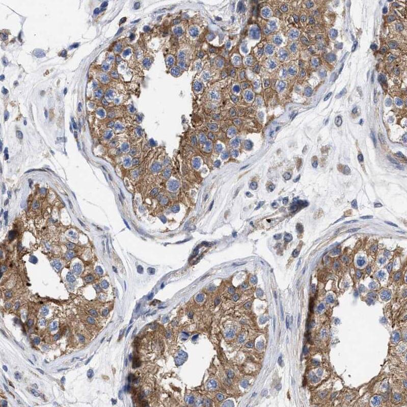 HS3ST5 Antibody - BSA Free Immunohistochemistry-Paraffin: HS3ST5 Antibody - BSA Free [NBP1-89373]