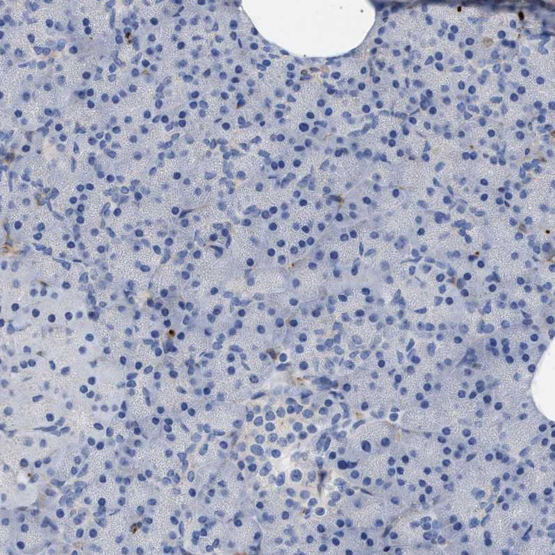 HS3ST5 Antibody - BSA Free Immunohistochemistry-Paraffin: HS3ST5 Antibody - BSA Free [NBP1-89373]