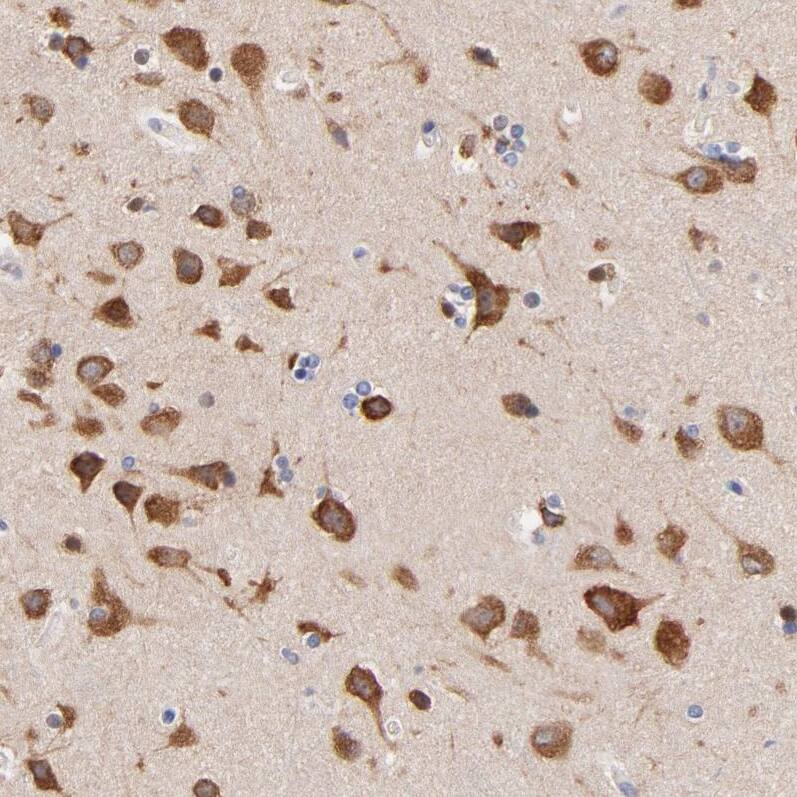 Heparan Sulfate 3-O-Sulfotransferase 1/HS3ST1 Antibody - BSA Free Immunohistochemistry-Paraffin: Heparan Sulfate 3-O-Sulfotransferase 1/HS3ST1 Antibody - BSA Free [NBP1-89375]