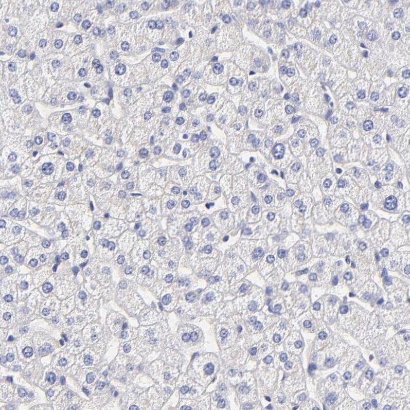 Heparan Sulfate 3-O-Sulfotransferase 1/HS3ST1 Antibody - BSA Free Immunohistochemistry-Paraffin: Heparan Sulfate 3-O-Sulfotransferase 1/HS3ST1 Antibody - BSA Free [NBP1-89375]