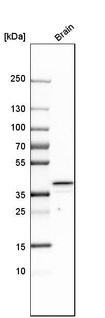 Heparan Sulfate 3-O-Sulfotransferase 1/HS3ST1 Antibody - BSA Free Western Blot: Heparan Sulfate 3-O-Sulfotransferase 1/HS3ST1 Antibody - BSA Free [NBP1-89375]