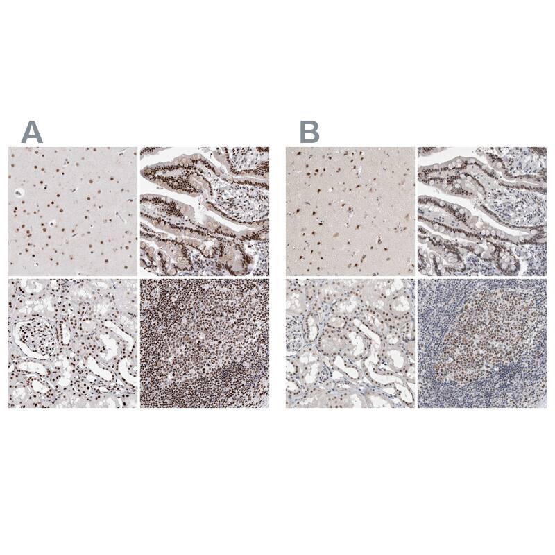 RBM6 Antibody - BSA Free Immunohistochemistry-Paraffin: RBM6 Antibody - BSA Free [NBP1-89377]
