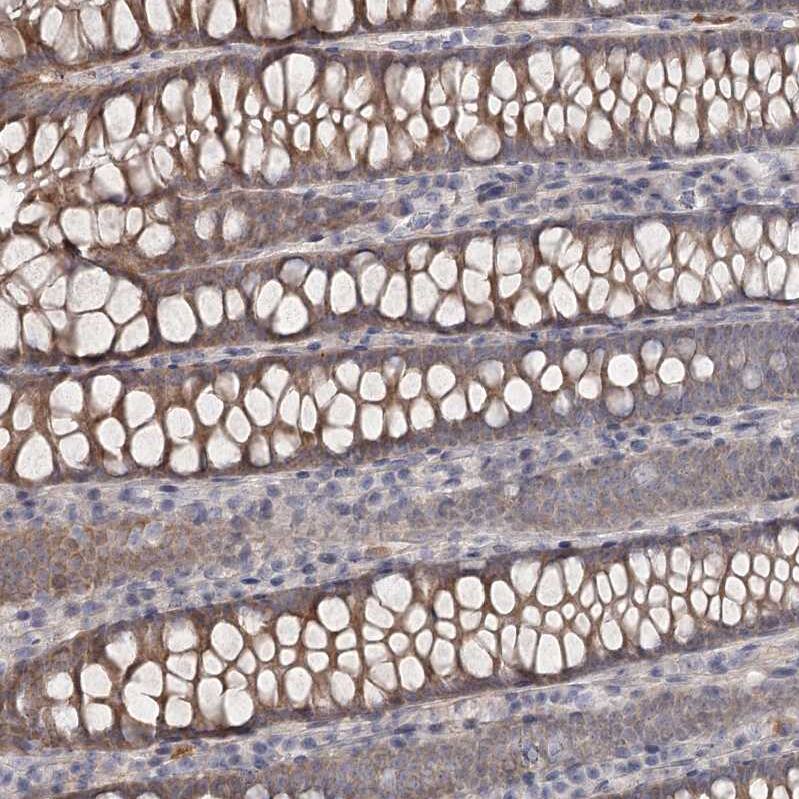 DHRS9 Antibody - BSA Free Immunohistochemistry-Paraffin: DHRS9 Antibody - BSA Free [NBP1-89378]