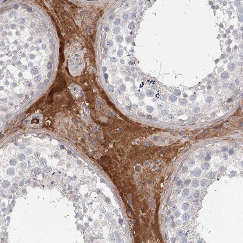 DHRS9 Antibody - BSA Free Immunohistochemistry-Paraffin: DHRS9 Antibody - BSA Free [NBP1-89378]