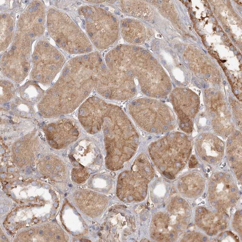 DHRS9 Antibody - BSA Free Immunohistochemistry-Paraffin: DHRS9 Antibody - BSA Free [NBP1-89378]