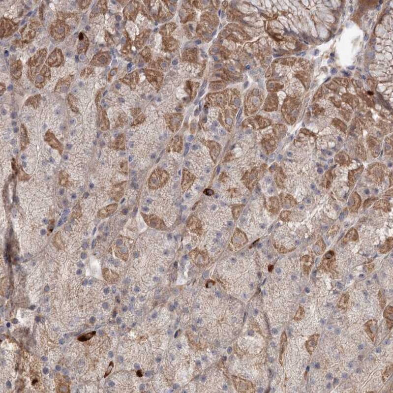 DHRS9 Antibody - BSA Free Immunohistochemistry-Paraffin: DHRS9 Antibody - BSA Free [NBP1-89378]