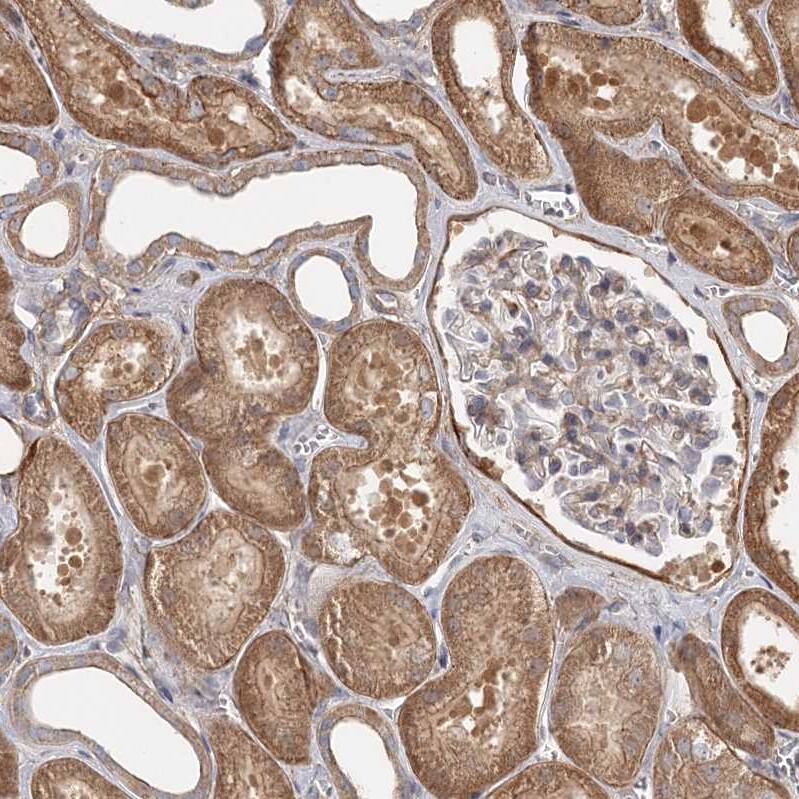 DHRS9 Antibody - BSA Free Immunohistochemistry-Paraffin: DHRS9 Antibody - BSA Free [NBP1-89379]